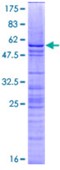 SDS-PAGE (H1F0-4528H).jpg